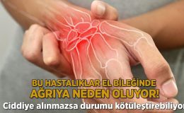 Bu hastalıklar el bileğinde ağrıya neden oluyor! Ciddiye alınmazsa durum kötüleşebiliyor