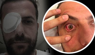 Eyüpsporlu Uğur Demirok canlı yayında isyan etti! ‘Resmen öldürmeye teşebbüs’