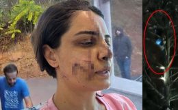 ’40 dikişli’ dehşette korkunç detaylar: Ağaca tırmanıp saklandı, taksiyle kapısına dayandı