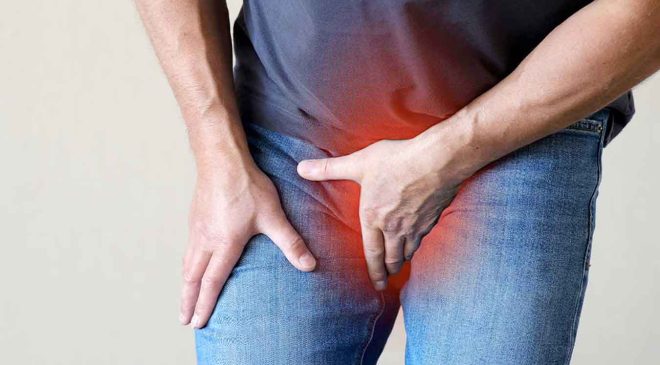 Varikosel ve Varikosel ameliyatı: Bilmeniz gerekenler