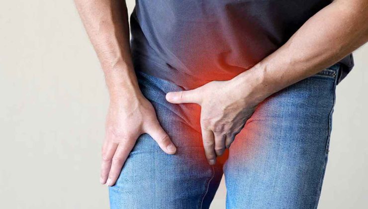 Varikosel ve Varikosel ameliyatı: Bilmeniz gerekenler